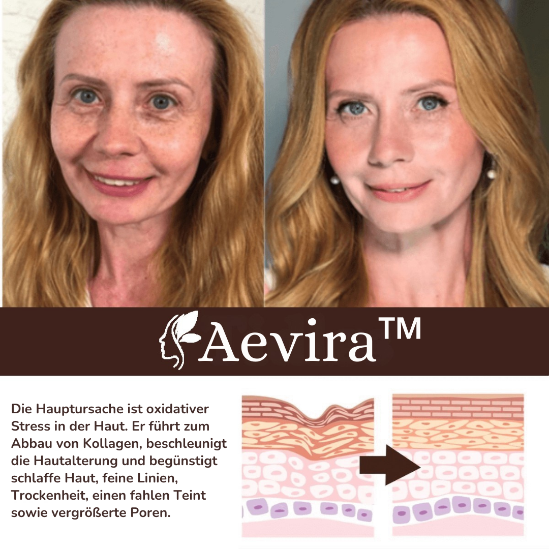 Aevira™ Retinol Cream für ein sichtbar jüngeres Aussehen in nur 7 Tagen!