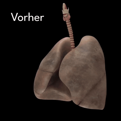 Brevia™ Eibisch-Extrakt | Saubere Lungen, freie Atemwege in nur 4 Tagen!