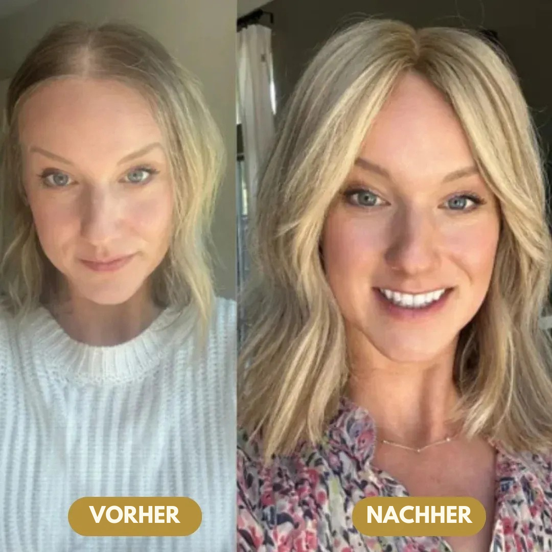 Capilux™ – Haar-Erneuerungs- & Vitalitätsserum | Bis zu 97 % Natürliches Haarwachstum in 2–3 Wochen