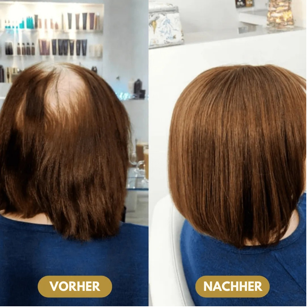 Capilux™ – Haar-Erneuerungs- & Vitalitätsserum | Bis zu 97 % Natürliches Haarwachstum in 2–3 Wochen