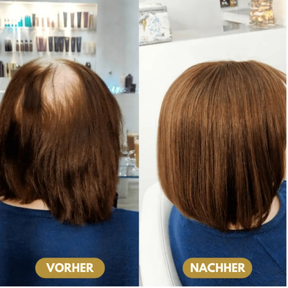 Capilux™ – Haar-Erneuerungs- & Vitalitätsserum | Bis zu 97 % Natürliches Haarwachstum in 2–3 Wochen