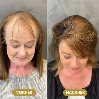 Capilux™ – Haar-Erneuerungs- & Vitalitätsserum | Bis zu 97 % Natürliches Haarwachstum in 2–3 Wochen