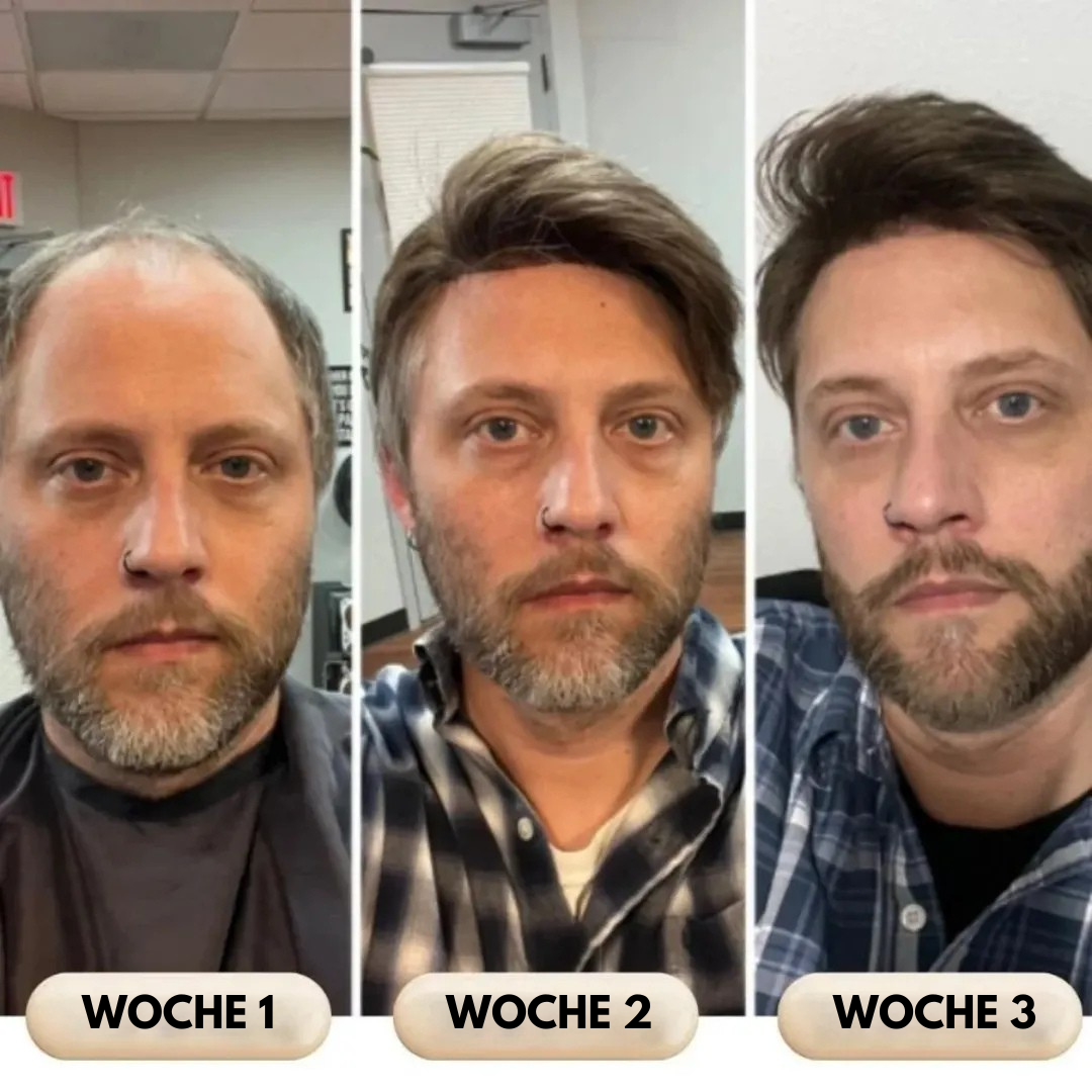 Capilux™ – Haar-Erneuerungs- & Vitalitätsserum | Bis zu 97 % Natürliches Haarwachstum in 2–3 Wochen