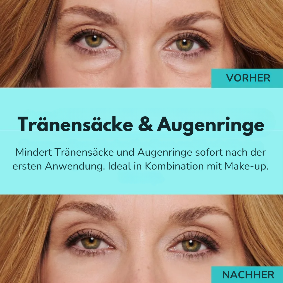 CELYN™ Lumière – Klinische Hautpflege für sofortige Augenstraffung