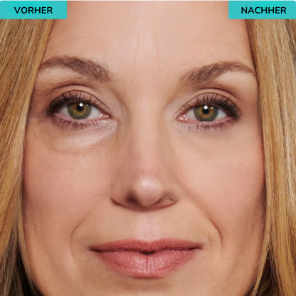 CELYN™ Lumière – Klinische Hautpflege für sofortige Augenstraffung