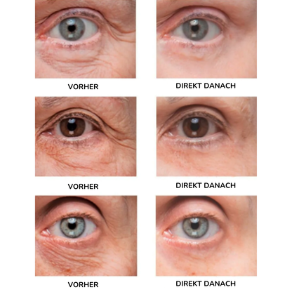 CELYN™ Lumière – Klinische Hautpflege für sofortige Augenstraffung