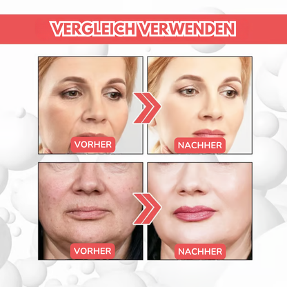Collagenique™ Anti-Aging Serum – Kollagen-Booster, Anti-Aging. Für alle Hauttypen geeignet