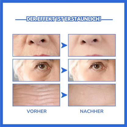 Collagenique™ Anti-Aging Serum – Kollagen-Booster, Anti-Aging. Für alle Hauttypen geeignet