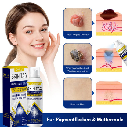 CryoTag™ Skin Spray | Unterstützt die Verbesserung der Hautstruktur in 7 Tagen!