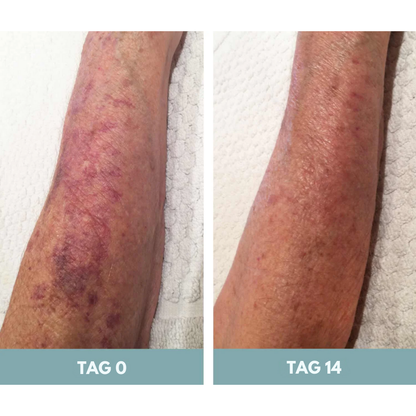 EpiLume™ All-in-One Hautpflege-Lösung Crem