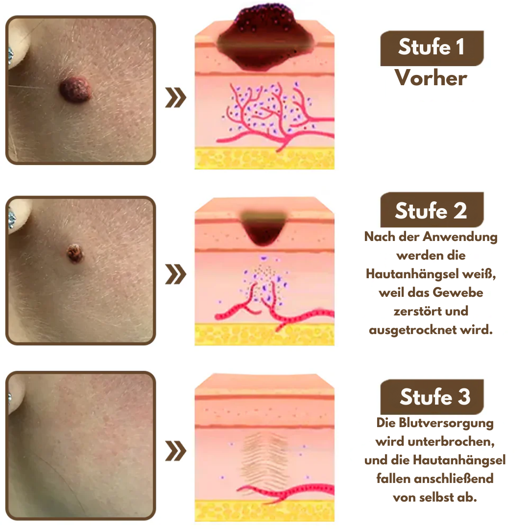 EpiLume™ All-in-One Hautpflege-Lösung Crem