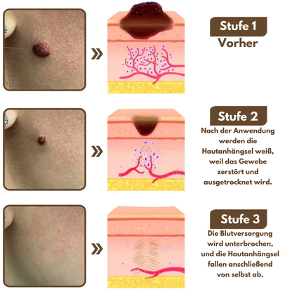 EpiLume™ All-in-One Hautpflege-Lösung Crem