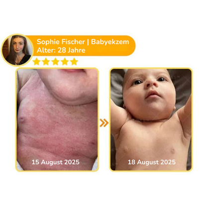 HautVera™ Ganzkörper-Hautregenerationscreme