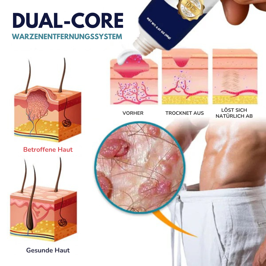 IntimaCure™ – Schnellwirkende Genitalwarzen-Entferner für sensible Haut