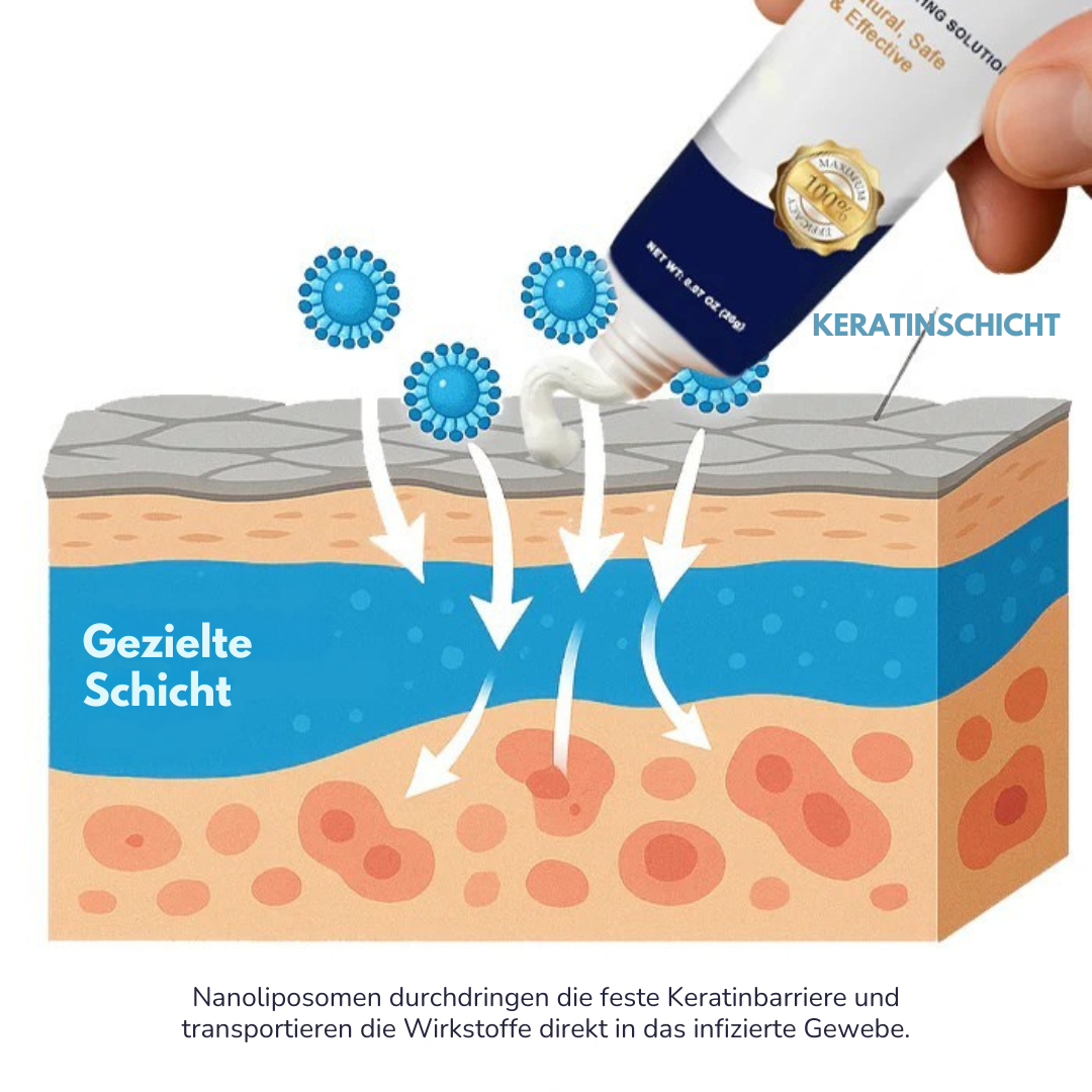 IntimaCure™ – Schnellwirkende Genitalwarzen-Entferner für sensible Haut