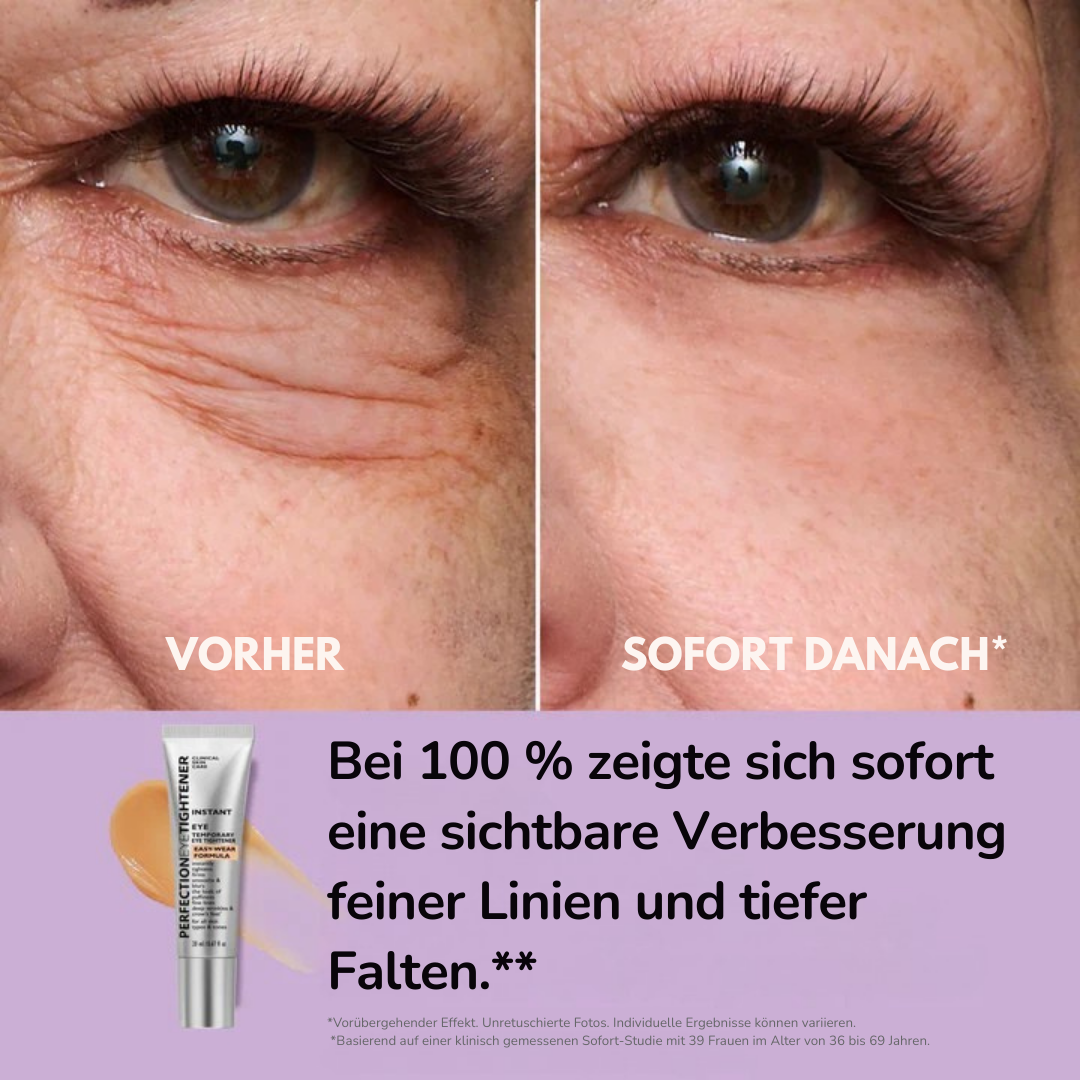 Kléra™ – Sofortige Straffungslösung für den Unteraugenbereich