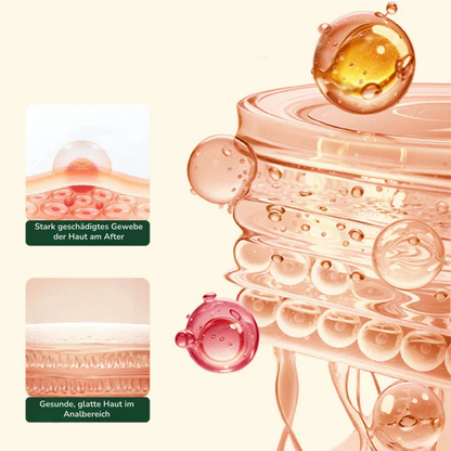 ProctiCare™ Beruhigendes & kühlendes Gel | Schnell wirkendes Hämorrhoiden-Gel