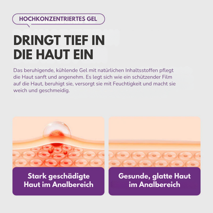 ProctiCare™ Beruhigendes & kühlendes Gel | Schnell wirkendes Hämorrhoiden-Gel