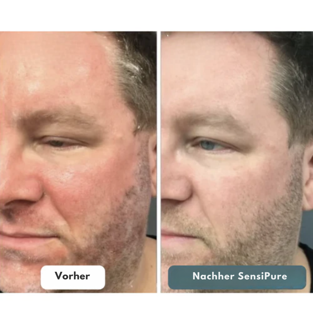 Sensipure Creme – Weiche und ausgeglichene Haut ohne Kompromisse