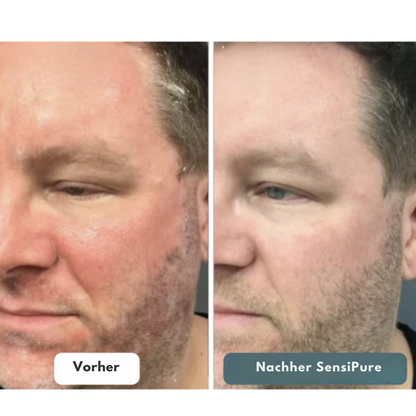 Sensipure Creme – Weiche und ausgeglichene Haut ohne Kompromisse