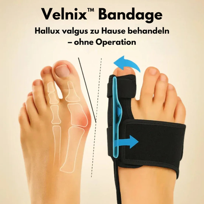 Velnix™ Schiene | Gezielt Zehen-Ausrichtung & Hallux-Korrektor