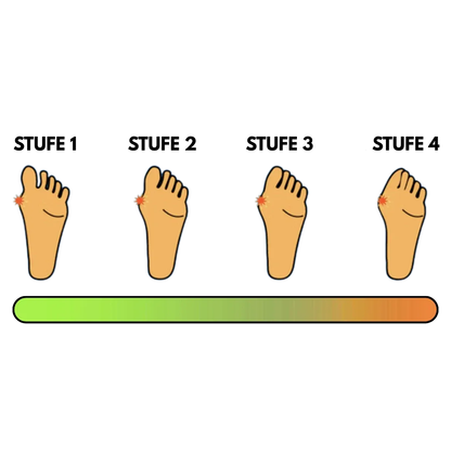 Velnix™ Schiene | Gezielt Zehen-Ausrichtung & Hallux-Korrektor